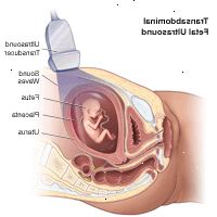Illustrazione di transaddominale ecografia fetale