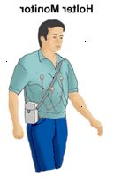 Illustrazione di un uomo che indossa un Holter