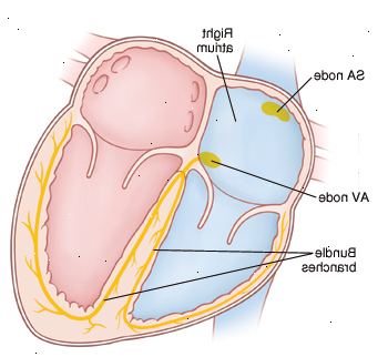 Diagramma che mostra il sistema elettrico del cuore