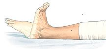 Pompe caviglia aiutano a ridurre il gonfiore e prevenire la formazione di coaguli di sangue.