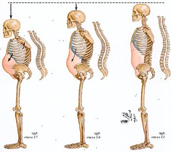 Come la colonna vertebrale comprime con l'età