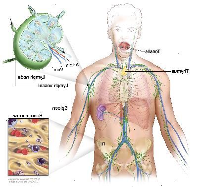 Sistema linfatico; disegno mostra i vasi linfatici e gli organi linfatici, compresi i linfonodi, tonsille, timo, milza e midollo osseo. Un inserto mostra la struttura interna di un linfonodo e vasi linfatici allegati con frecce che indicano come la linfa (liquido chiaro) si muove dentro e fuori del linfonodo. Un altro inserto mostra un primo piano di midollo osseo con cellule del sangue.