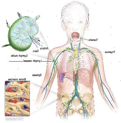 Sistema linfatico; disegno mostra i vasi linfatici e gli organi linfatici, compresi i linfonodi, tonsille, timo, milza e midollo osseo. Un inserto mostra la struttura interna di un linfonodo e vasi linfatici allegati con frecce che indicano come la linfa (liquido chiaro) si muove dentro e fuori del linfonodo. Un altro inserto mostra un primo piano di midollo osseo con cellule del sangue.