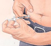 Paziente iniezione di insulina nell'addome