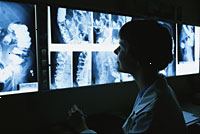 Immagine di un medico visione clisma opaco film x-ray