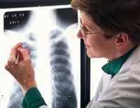 Immagine di un radiologo femmina lettura di un x-ray