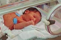 Immagine di un bambino in terapia intensiva neonatale