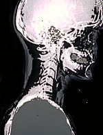 Un ritratto di una radiografia della testa
