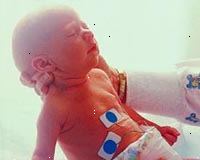 Immagine di un neonato in terapia intensiva neonatale