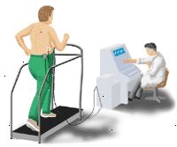 Illustrazione dimostrando un ECG da sforzo